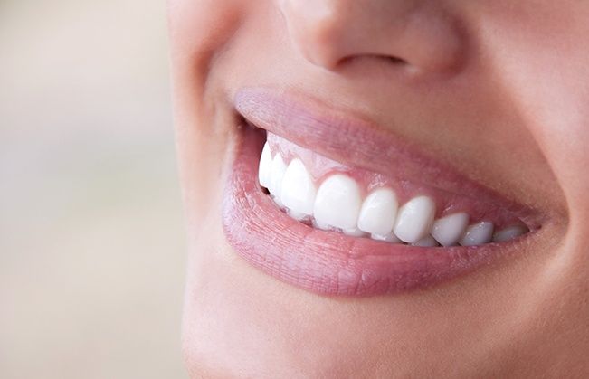 Closeup of smile after teeth whitening treatment