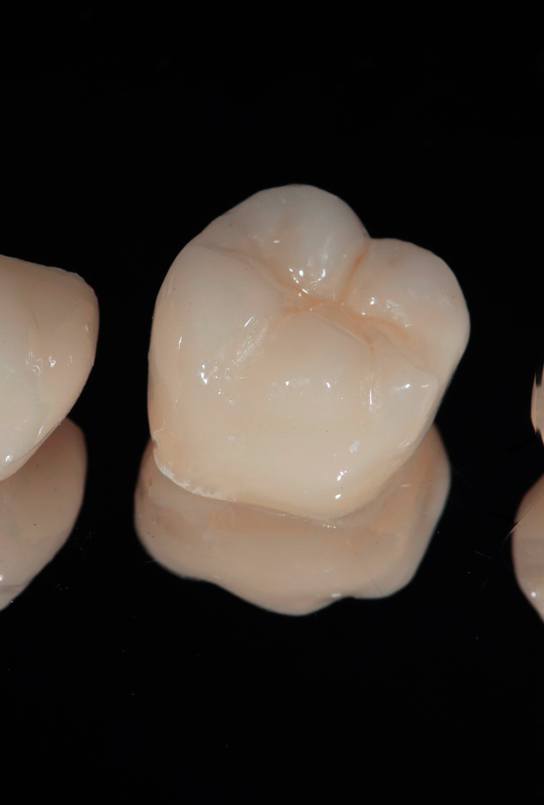 Three dental crowns in Auburn on reflective surface