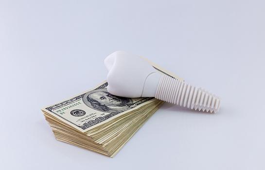 Dental implant in Auburn, WA, lying on stack of money