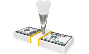 Dental implant in Auburn, WA standing on stack of money
