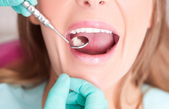 Dentist examining patient's smile after tooth-colroed filling treatment