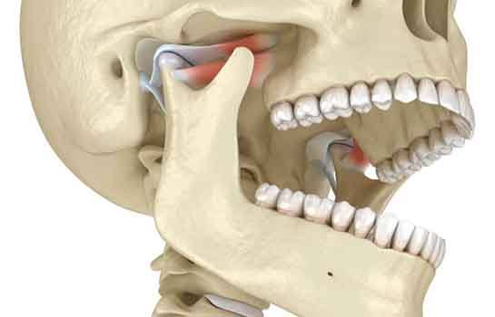 Illustration of human skull, with TMJs highlighted